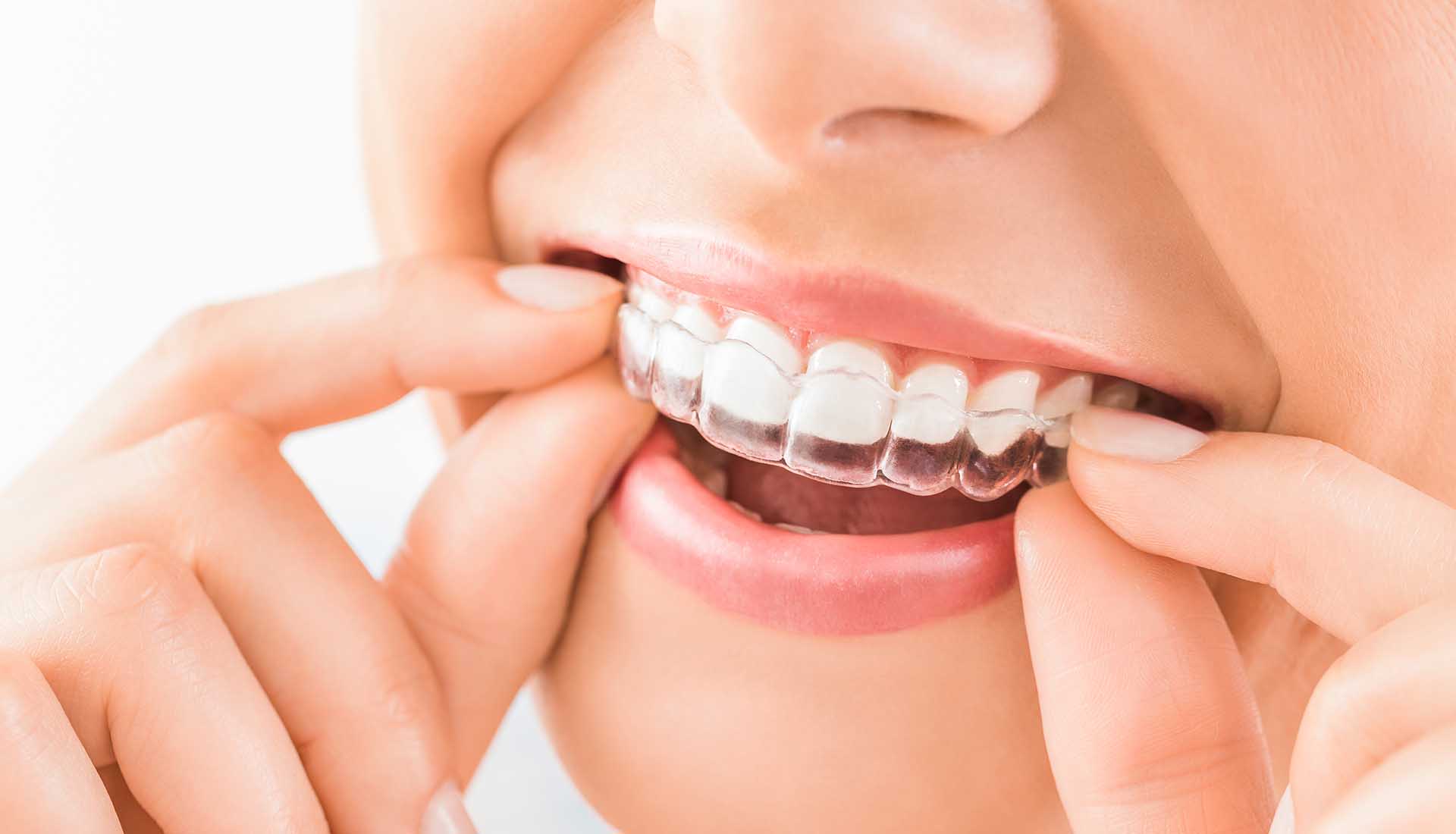 Orthodontic Dentistry